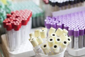 Kuvituskuva, Näytteenottopulloja laboratoriossa