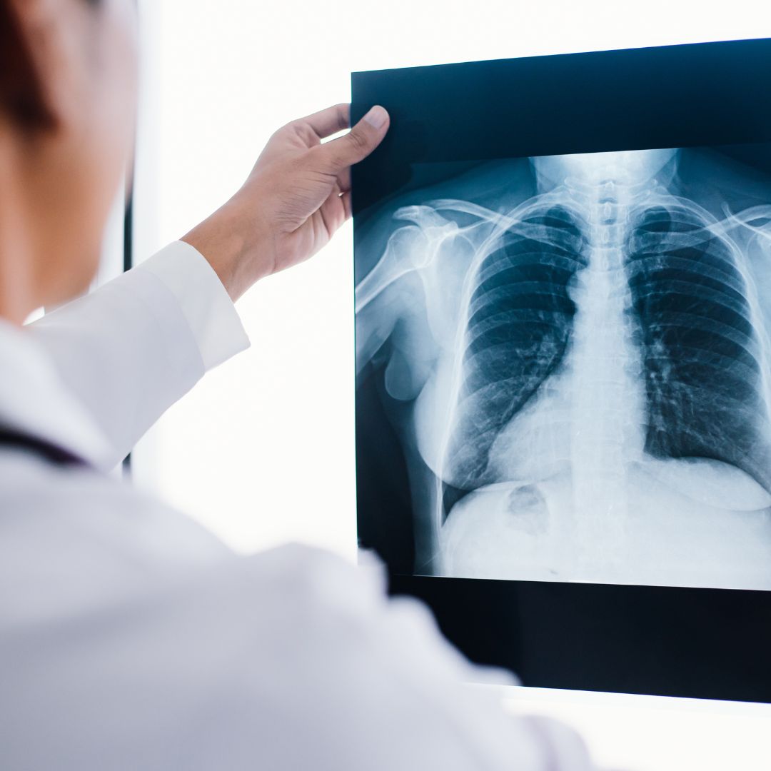 HUS Diagnostiikkakeskus: Parikkalan hammaskuvauslaite rikki, odotettavissa pitempiaikainen katkos toimintaan