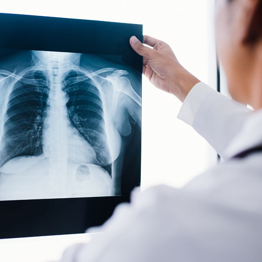 HUS Diagnostiikkakeskus tiedottaa: Parikkalan röntgen on ajalla 17.11.–5.12. avoinna ainoastaan kahtena keskiviikkona